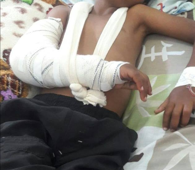 Teixeira de Freitas: Mãe denuncia descaso na saúde. Com aparelho quebrado, criança de 06 anos sofre a espera de cirurgia