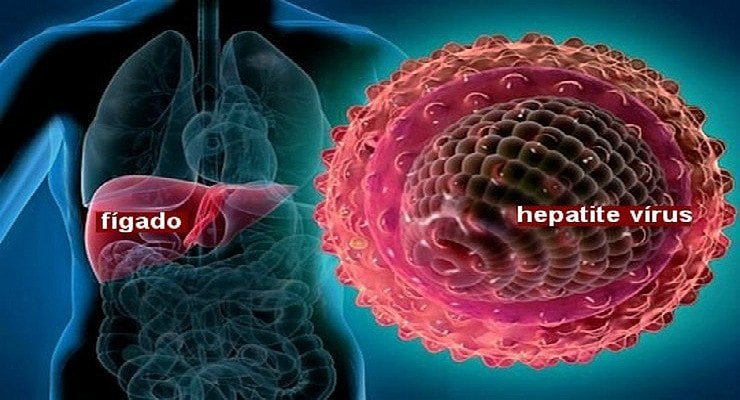 Hepatite A: saiba como se pega o vírus, quais são os sintomas e tratamentos