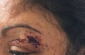 Mucuri: Pais de aluno agridem funcionária de escola