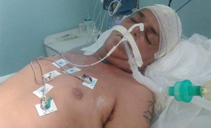 Teixeira de Freitas: Suposto professor da UNEB está em coma no HMTF. Sem documentos, hospital busca familiares