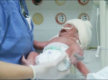 Caso raro, gêmeas nascem com três dias de diferença em partos normais no Paraná