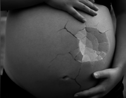 Pesquisa revela que 41% dos brasileiros são contra qualquer tipo de aborto