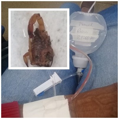 Mulher é picada por escorpião no Santo Guimarães em Teixeira de Freitas