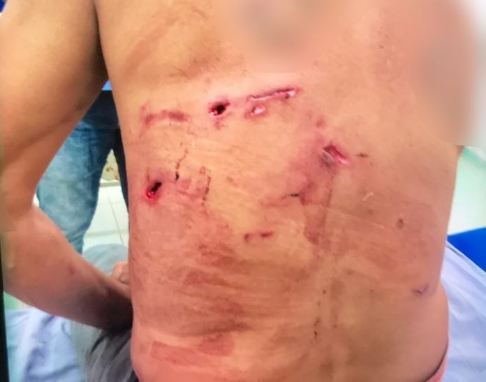 Cachorros salvam o dono de ataque de onça-pintada