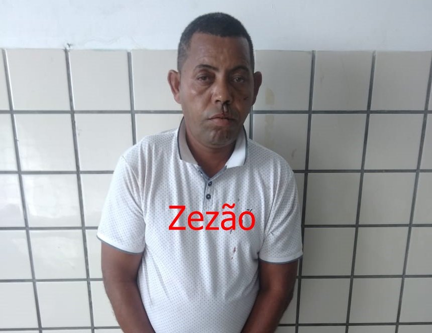 Bêbado, irmão de vereador atropela pescador que teve a perna dilacerada em Nova Viçosa