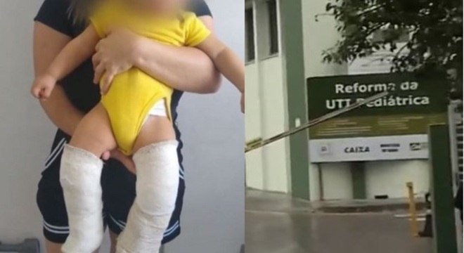 Homem quebra perna de seu enteado de apenas 10 meses