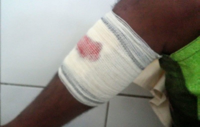 Homem é perseguido e baleado na cidade do Prado