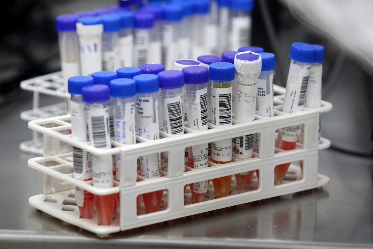 Teixeira de Freitas registra mais um caso do Covid-19