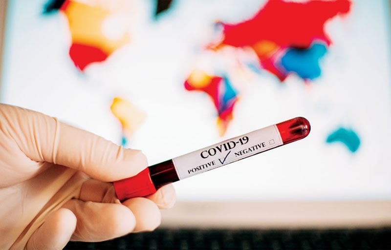 Médica de 33 anos testa positivo para coronavírus em Teixeira de Freitas