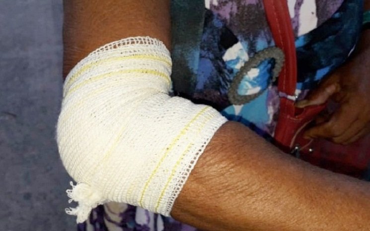 Homem espanca vizinha idosa por causa de som alto