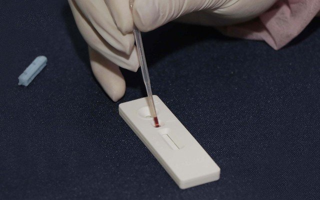 Bahia tem 1.766 novos casos e passa de 30,4 mil infectados pela Covid-19