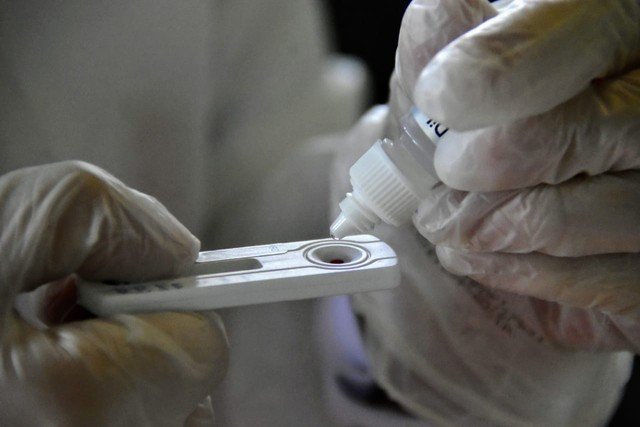 Brasil tem 1.187 mortes por coronavírus em 24 horas e passa de 1,7 milhão de infectados