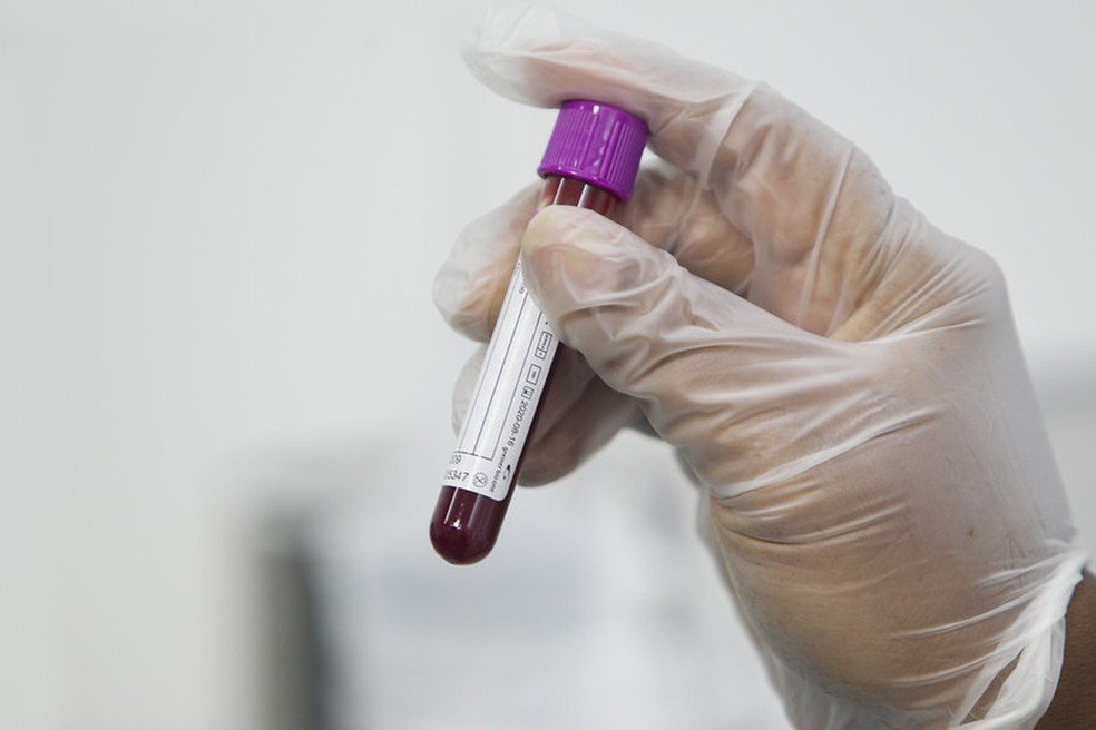 Hemoba tem estoque crítico de bolsas de sangue por causa de queda nas doações