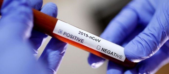 Brasil registra 101.136 mortes, 593 delas em 24 horas