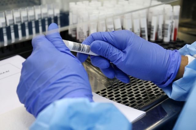 Covid-19: Brasil registra 29,3 milhões de casos e 655 mil óbitos