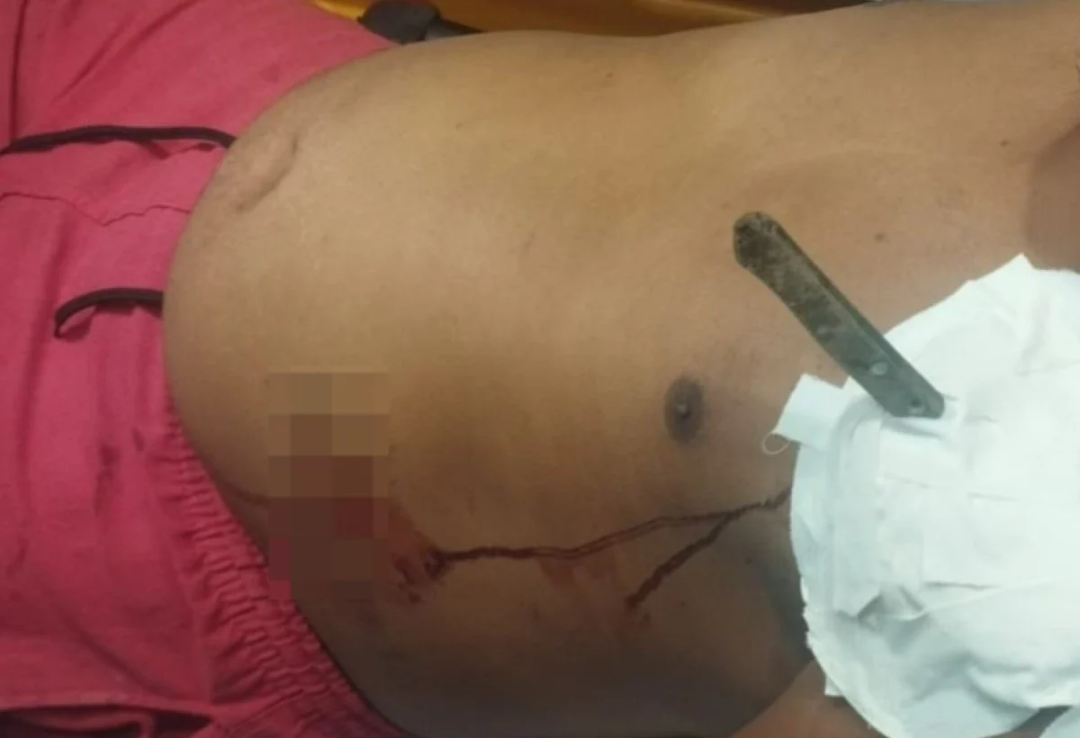 Homem é socorrido com faca cravada no corpo no sul da Bahia; ex-companheira é a principal suspeita