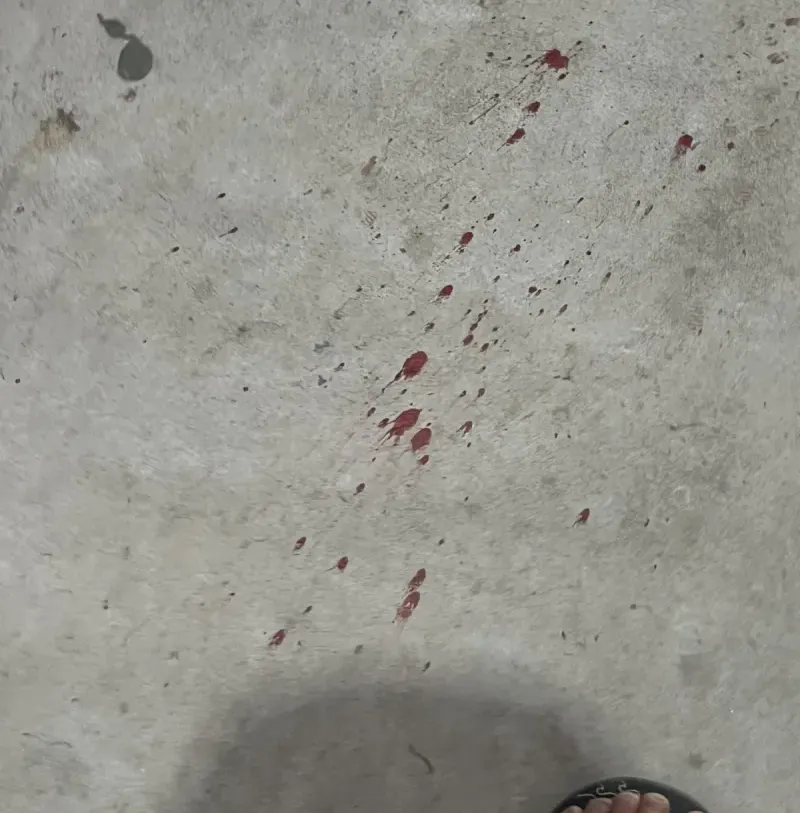 Itabela: “Papa-Léguas” é baleado após ser perseguido por atiradores dentro do Mercadão